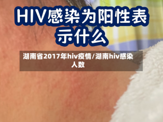 湖南省2017年hiv疫情/湖南hiv感染人数