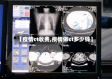 【疫情ct收费,疫情做ct多少钱】