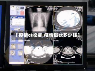 【疫情ct收费,疫情做ct多少钱】