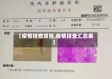 【疫情排查项目,疫情排查汇总表】