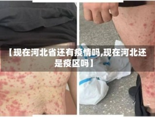 【现在河北省还有疫情吗,现在河北还是疫区吗】