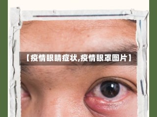 【疫情眼睛症状,疫情眼罩图片】