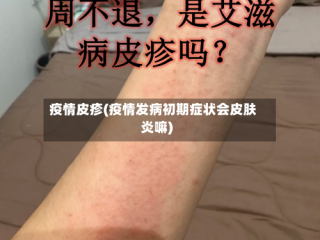 疫情皮疹(疫情发病初期症状会皮肤炎嘛)