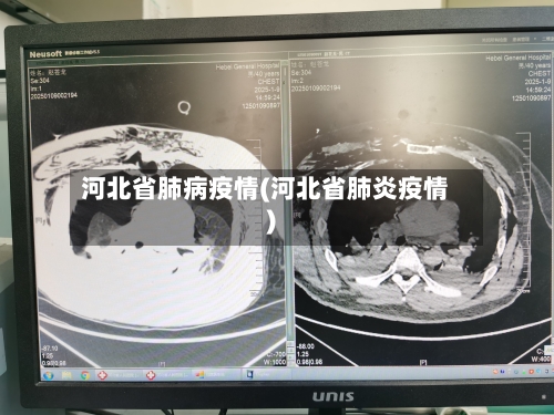 河北省肺病疫情(河北省肺炎疫情)-第2张图片