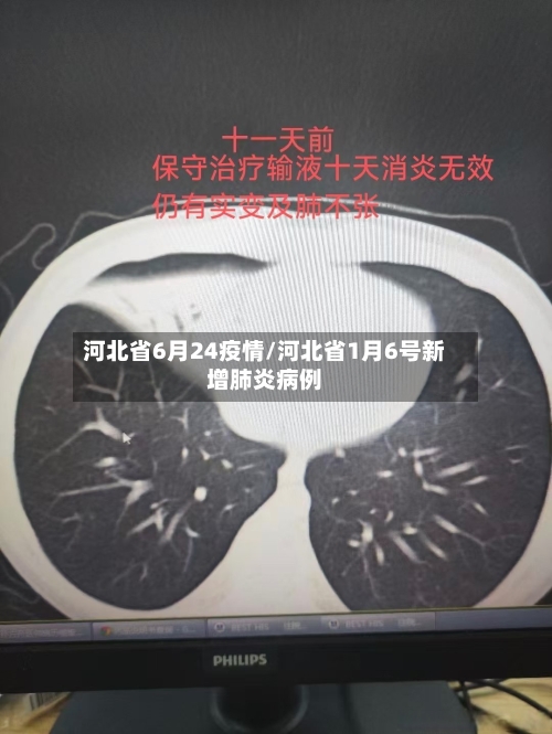 河北省6月24疫情/河北省1月6号新增肺炎病例-第1张图片
