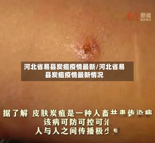 河北省易县炭疽疫情最新/河北省易县炭疽疫情最新情况-第3张图片