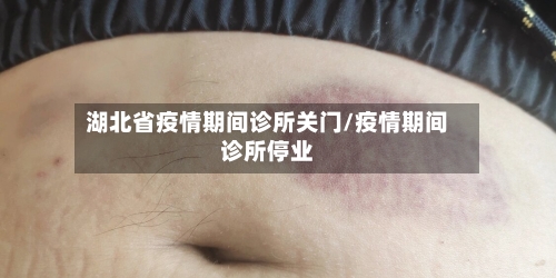 湖北省疫情期间诊所关门/疫情期间诊所停业-第1张图片
