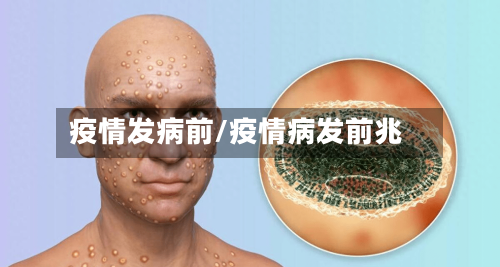 疫情发病前/疫情病发前兆-第1张图片