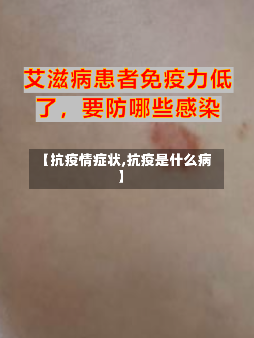 【抗疫情症状,抗疫是什么病】-第1张图片