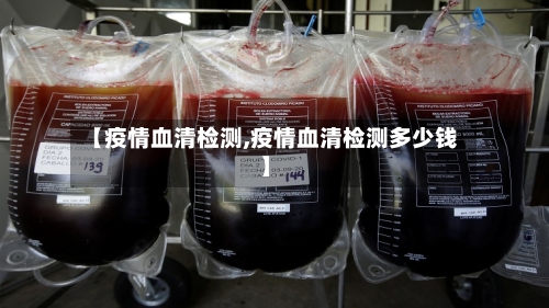 【疫情血清检测,疫情血清检测多少钱】-第3张图片