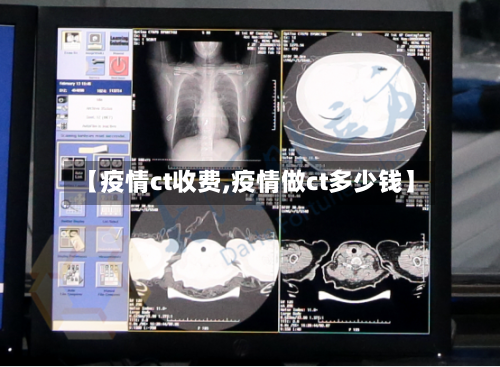 【疫情ct收费,疫情做ct多少钱】-第1张图片