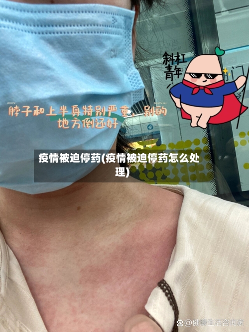疫情被迫停药(疫情被迫停药怎么处理)-第2张图片